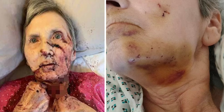 İngiltere’de yaşlı bir kadın gece uykusunda fare saldırısına uğradı